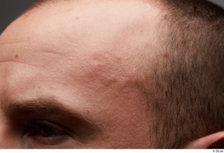 HD face Skin Joel eyebrow face forehead hair skin pores…